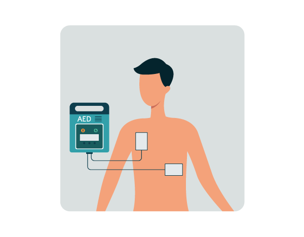 AED placement - adult