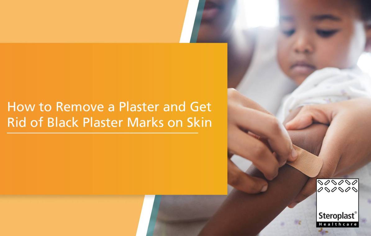 How to Remove a Plaster and Get Rid of Black Plaster Marks on Skin