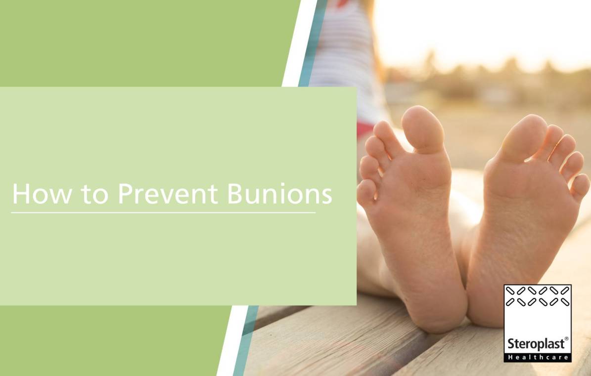 How to Prevent Bunions