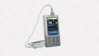 300M Handheld Pulse Oximeter – SpO₂ & Pulse Rate Monitor – 2.8" TFT Display – 72hr Data Storage