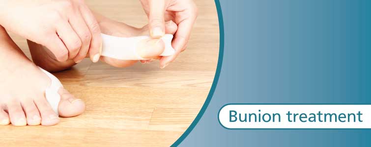 Bunion treatment 