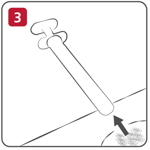 Step 3 Remove the Applicator