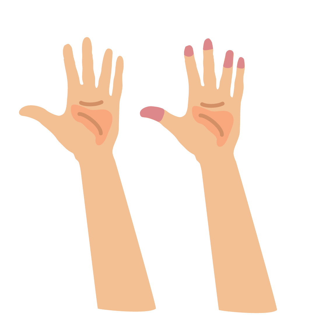 Make sure you monitor the blood circulation in the casualty's fingertips on the injured arm every 10 minutes