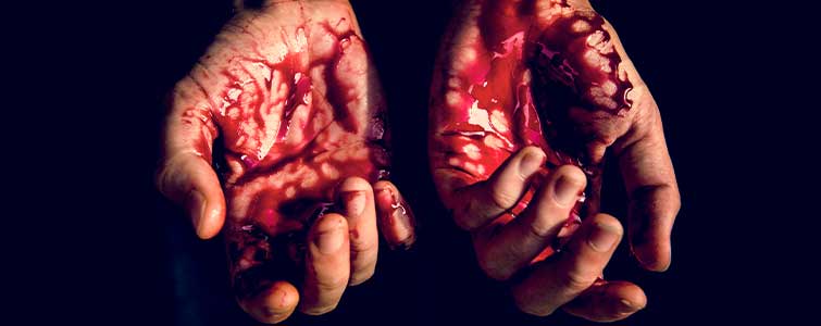 Steps to take to prevent severe blood loss 