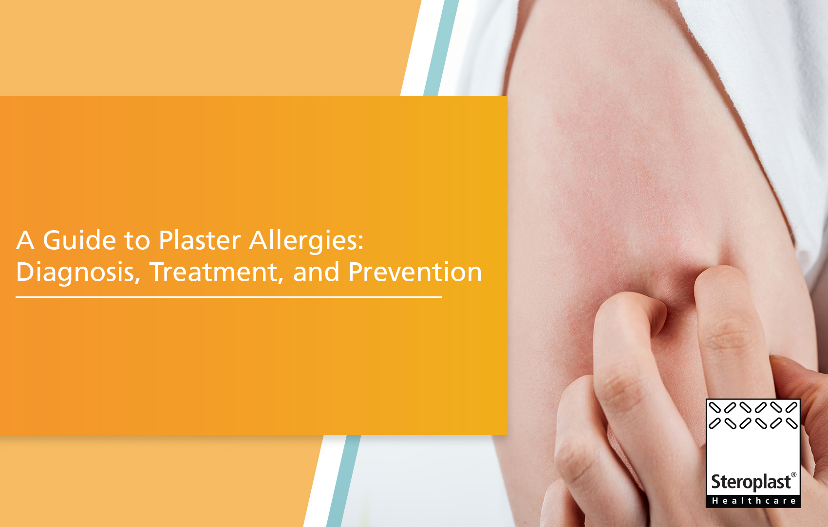 A Guide to Plaster Allergies: Diagnosis, Treatment, and Prevention