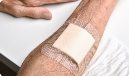 Adhesive plaster on arm