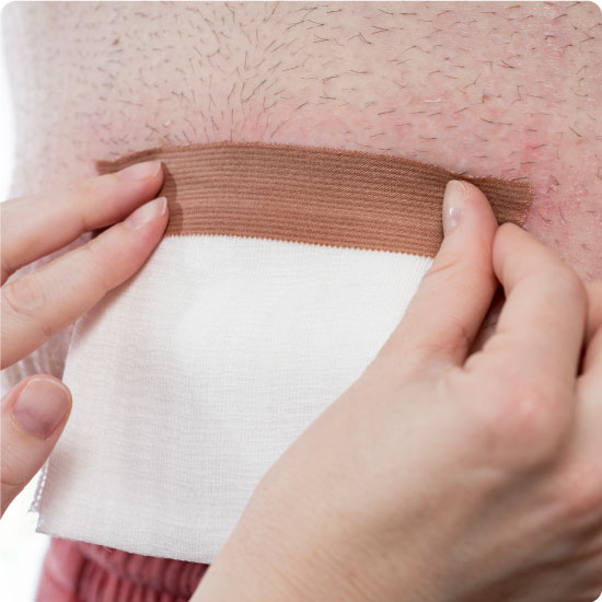 Adhesive dressing tape on mans stomach