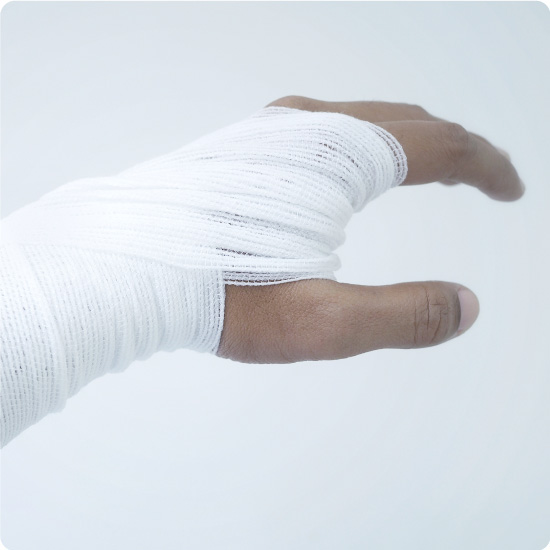 Conforming bandage on hand