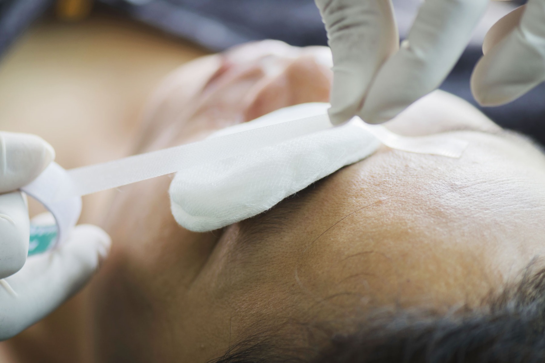Someone applying an eye dressing to someone else