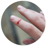 Cut on Finger