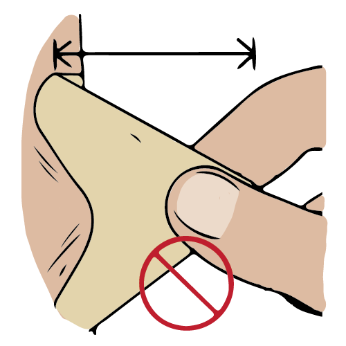 Medical tape being pulled upwards pulling the skin