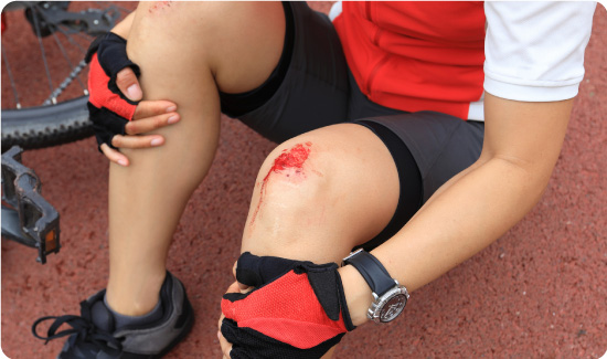 Cyclist with Knee Graze