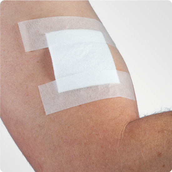 Microporous Tape Being Used to Secure Dressing