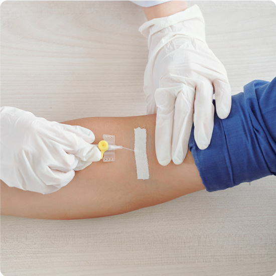 Microporous Tape Being Used to Secure Catheter