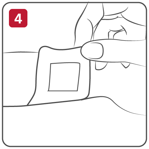 Step 4 change the dressing