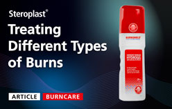 Treating Different Types of Burns Article Thumbnail