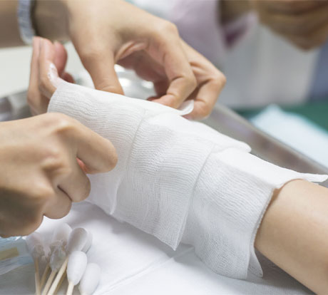someone with a burn being treated