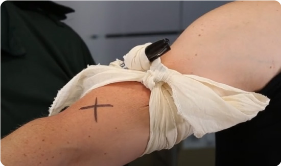 Triangular bandage being used as a tourniquet