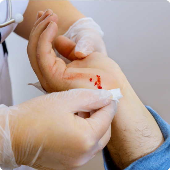Nurse Wiping Cut on Patients hand