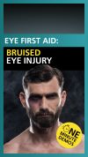 How do you treat a black eye? | Health Tips