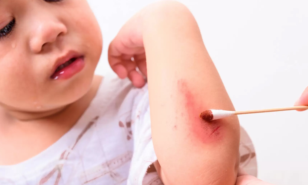 woman washing babies wound on arm