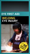 How do you treat a welding eye injury? | Health Tips | YouTube Shorts